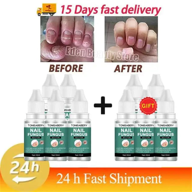 Nail Fungus Treatment Serum Foot Repair Liquid Toe Nails Fungal Removal Gel Anti Infection Paronychia Onychomycosis Cream 10ml