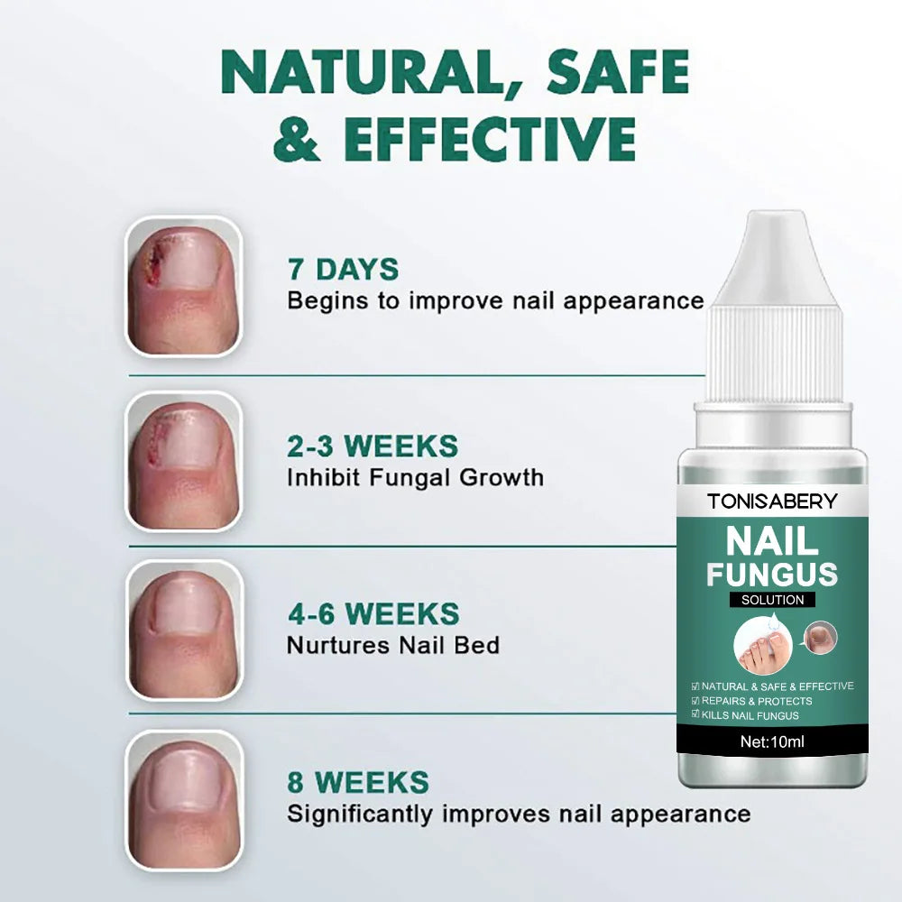 Nail Fungus Treatment Serum Foot Repair Liquid Toe Nails Fungal Removal Gel Anti Infection Paronychia Onychomycosis Cream 10ml