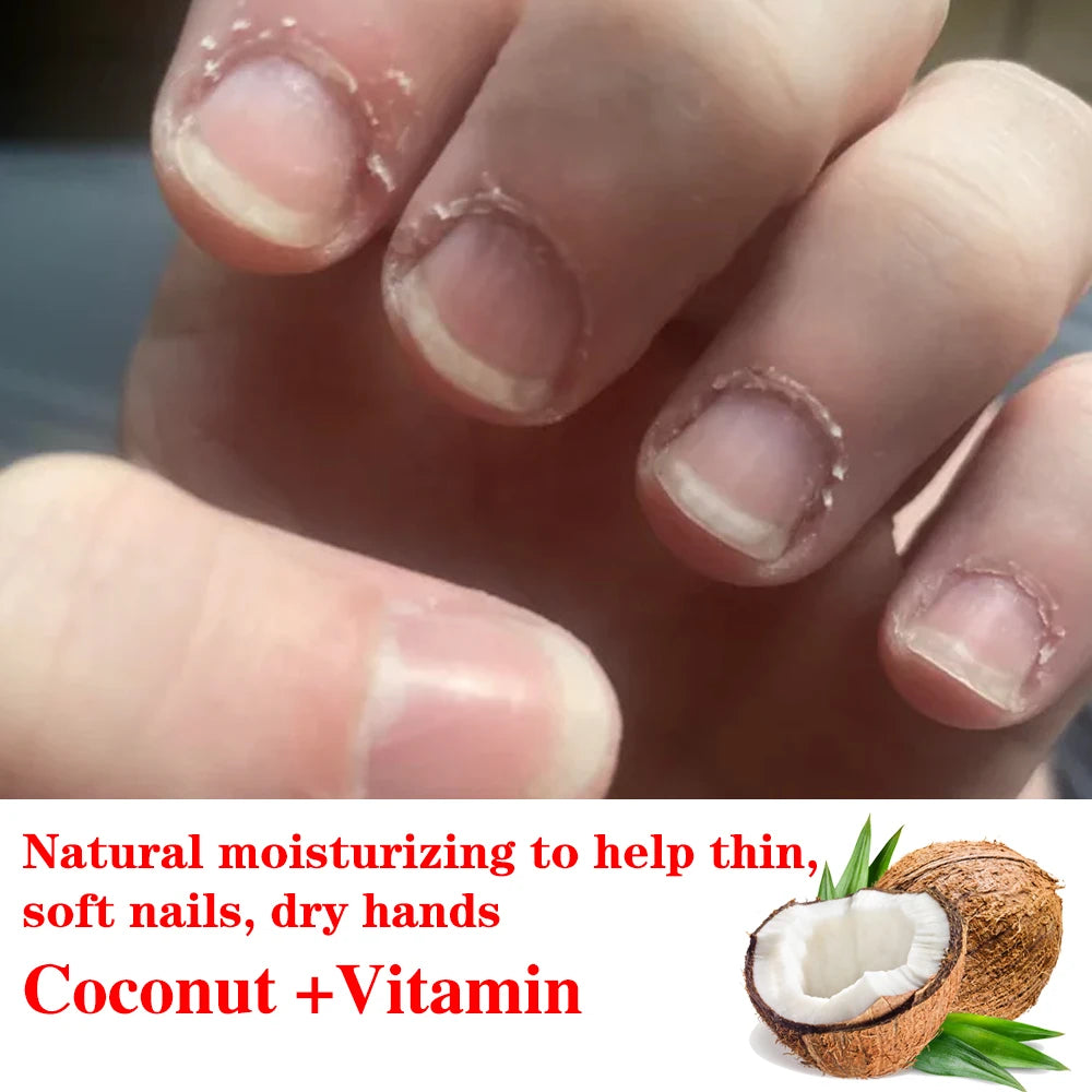 KODIES GEL Cuticle Oil Nail Art Treatment Coconut Vitamin C Repairs and Restores Cuticles Stronger Nails Nourishment Oil Care