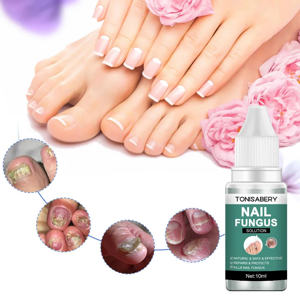 Nail Fungus Treatment Serum Foot Repair Liquid Toe Nails Fungal Removal Gel Anti Infection Paronychia Onychomycosis Cream 10ml
