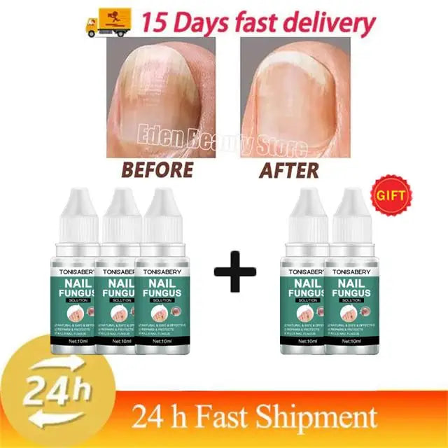 Nail Fungus Treatment Serum Foot Repair Liquid Toe Nails Fungal Removal Gel Anti Infection Paronychia Onychomycosis Cream 10ml