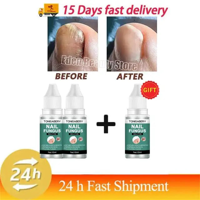 Nail Fungus Treatment Serum Foot Repair Liquid Toe Nails Fungal Removal Gel Anti Infection Paronychia Onychomycosis Cream 10ml