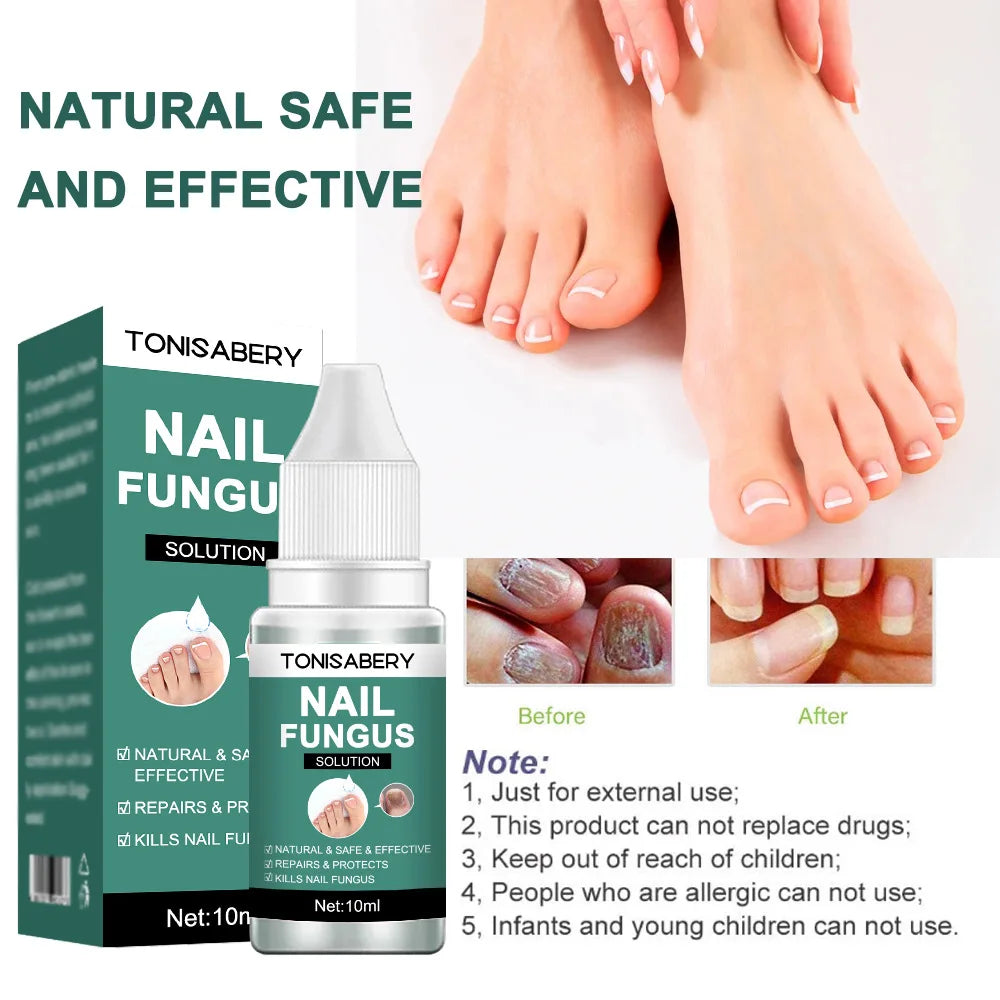 Nail Fungus Treatment Serum Foot Repair Liquid Toe Nails Fungal Removal Gel Anti Infection Paronychia Onychomycosis Cream 10ml