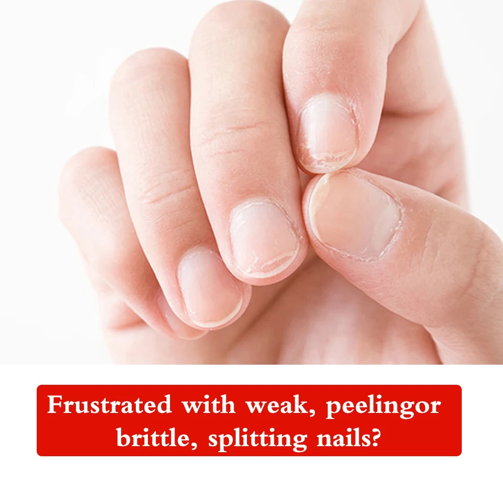 KODIES GEL Nail Strengthener Treatment for Soft Thin Nails Imperfection Keratin Base Coat Nail Growth System Natural Protein Oil